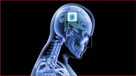 implant rfid chip brainwash|What to know about human brain implants .